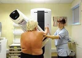 A woman undergoes breast cancer screening