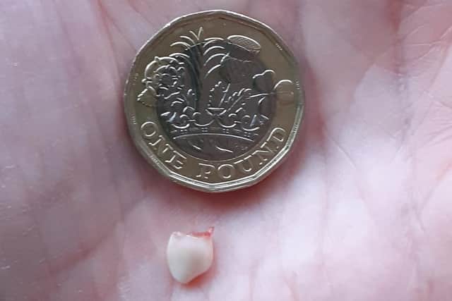 Harry's tooth and the £1 coin Natalie dropped off for him on his doorstep picture: supplied