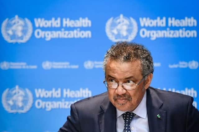 World Health OrganizationDirector-General Tedros Adhanom Ghebreyesus said: "This outbreak is a reminder that COVID 19 is not the only health threat people face." (Getty Images)