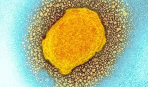 How monkeypox looks under a scientific microscope