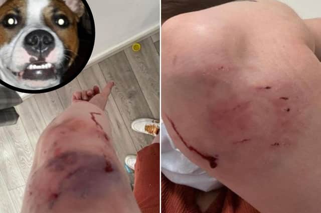 West Lothian Crime: Dog could be destroyed after attack in Livingston
