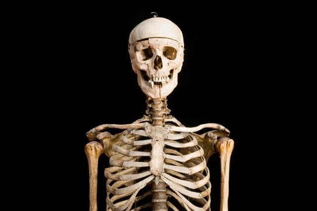 William Burke's skeleton will be going on display as part of the exhibition. Picture: Anatomical Museum