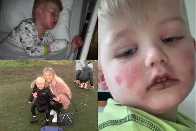 Freddie was hospitalised with with symptoms of Kawasaki disease, which has been linked to coronavirus in children.