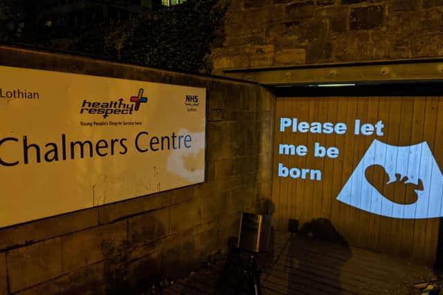 Images were beamed onto the Chalmers clinic walls