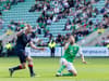 Hibs injury update ahead of Aston Villa clash after Dylan Vente is forced off late in Raith win