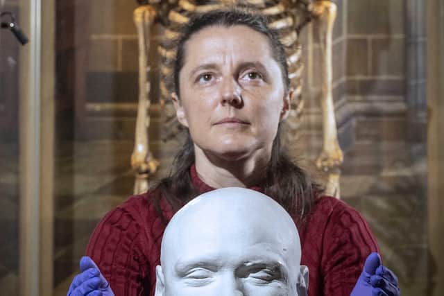 Curator Dr Tacye Phillipson with the skeleton and death mask of infamous 19th century Edinburgh murderer William Burke. Picture: Neil Hanna