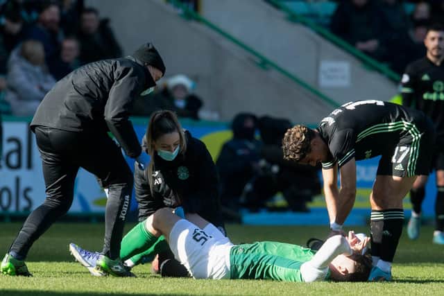 Kevin Nisbet sustained his ACL injury against Celtic at Easter Road on February 27. Picture: Craig Foy / SNS