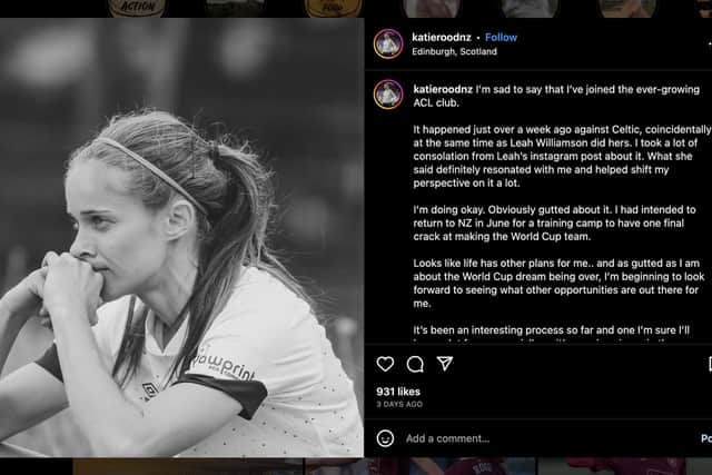 Katie Rood announced news of his injury in a social media post. Picture: Instagram