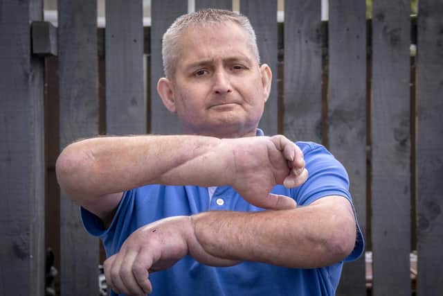 Steven Gallagher says his transplanted hands have given him 'a new lease of life'
Pic: Jane Barlow/PA