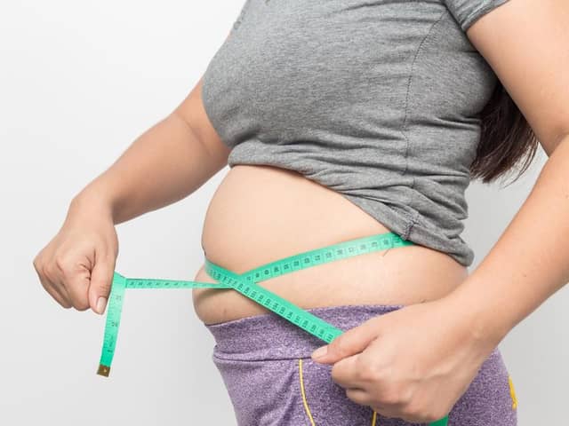 Obesity in the UK affects around one in every four adults