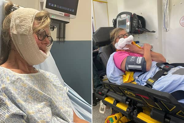 Edinburgh mum Heather Packwood has been left with horror injuries after her bike hit a pothole