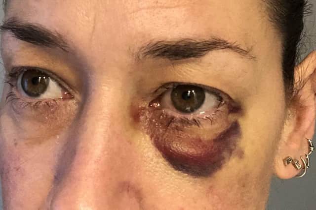 Fiona Campbell was assaulted