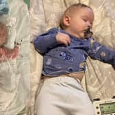 Blake Stewart, pictured just after he was born, and then after his first operation, one day after he was born.