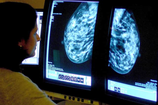 There are fears hundreds of breast cancer patients may have “fallen through the cracks”