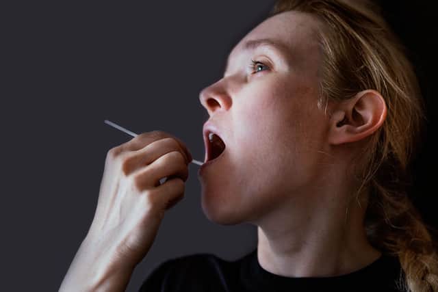 Researcheds are asking people to share their home DNA test results