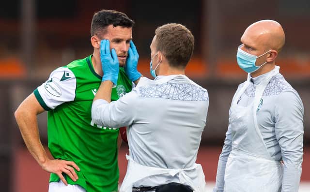 Hibs defender Paul McGinn is treated by the physio after a head clash with Dundee Utd's Jamie Robson during a Scottish Premiership match against Dundee United at Tannadicein August 2020
