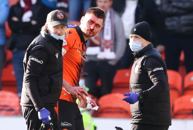 Dundee United's Ryan Edwards goes off injured after a challenge by Hearts' Ellis Simms.