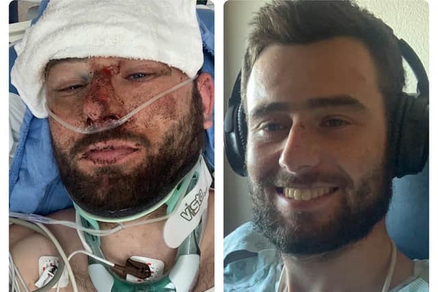 Josh Quigley pictured following his release from hospital after his crash in the US in 2019. Picture: Josh Quigley/Twitter