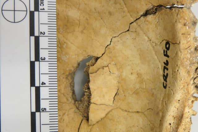 Female burial with head wound – evidence of a violent end for burial 5. (Photo credit: University of Aberdeen/SWNS)
