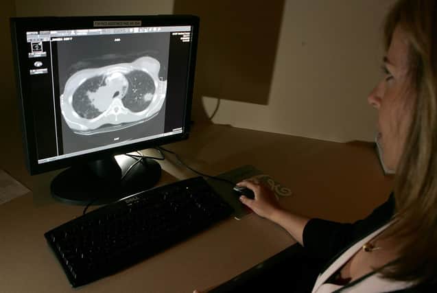 Modern scanning techniques can help surgeons find and remove tumours (Picture: Justin Sullivan/Getty Images)