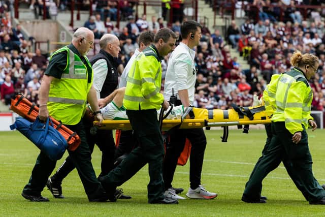 Chris Cadden being stretchered off against Hearts after damaging his Achilles. The Hibs midfielder will now be out for several months. Picture: SNS