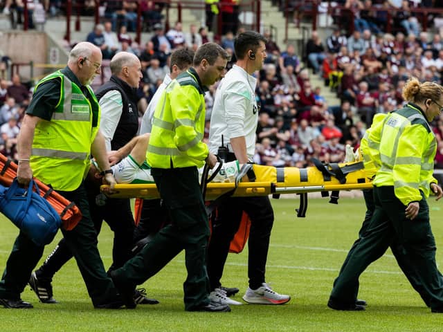 Chris Cadden being stretchered off against Hearts after damaging his Achilles. The Hibs midfielder will now be out for several months. Picture: SNS