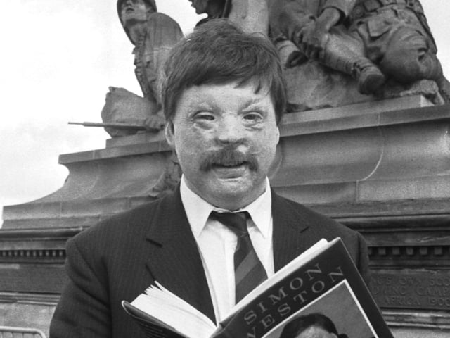 Simon Weston, who was badly burned when his ship Sir Galahad was hit during the Falklands conflict, was in Edinburgh to promote his autobiography 'Walking Tall' in March 1989.