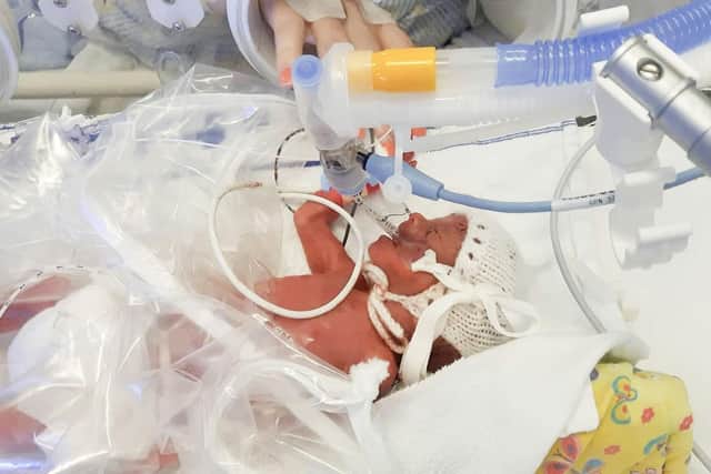 Aurora Devine at four hours old in an incubator. Pic: Contributed
