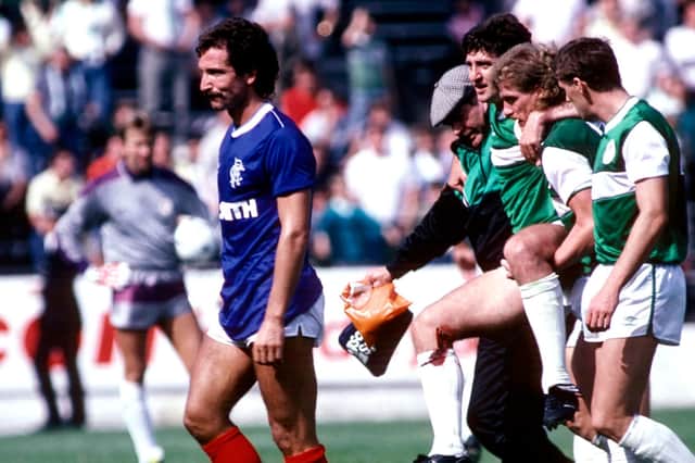 Graeme Souness leaves the field on his Rangers debut after receiving a red card for a challenge on Hibs' George McCluskey, who is helped off the pitch, on the opening day of the 1986/87 season.