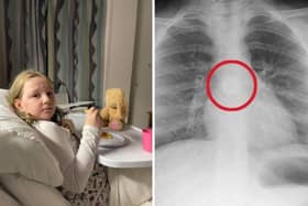 Child makes 'miraculous' recovery after swallowing battery then throwing it up in hospital