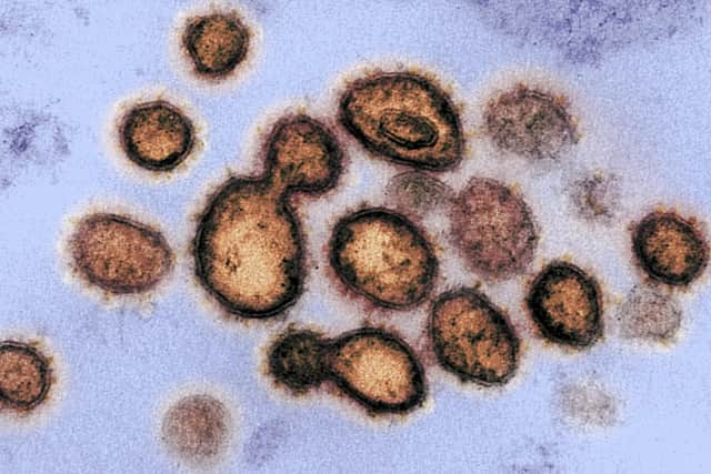 Coronavirus COVID-19(Photo by Handout / National Institutes of Health / AFP)