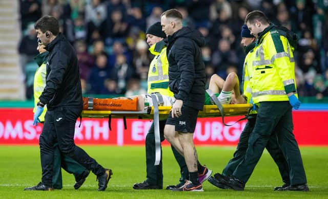 Hibs' Josh Campbell is stretchered off injured during the derby against Hearts.