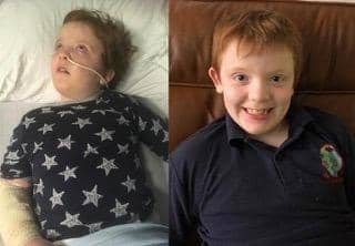 The picture on the left shows Murray in 2019 before he had access to cannabis oils. Murray's mum, Karen said the transformation has been 'incredible' and he has now been seizure for more than two years.