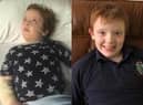 The picture on the left shows Murray in 2019 before he had access to cannabis oils. Murray's mum, Karen said the transformation has been 'incredible' and he has now been seizure for more than two years.