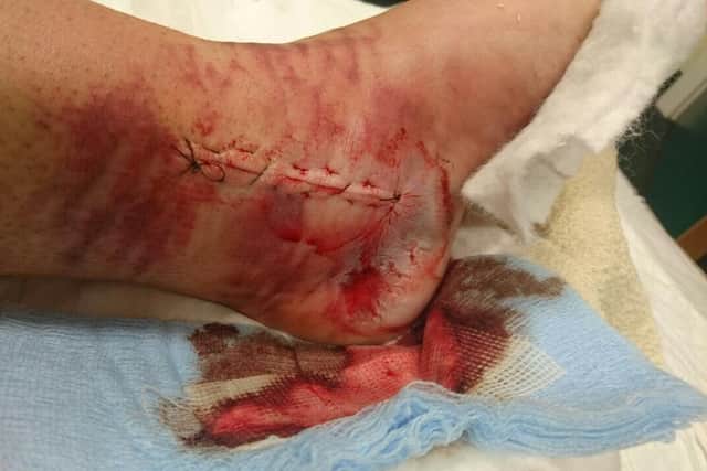 MacDonald shattered Joanne's ankle