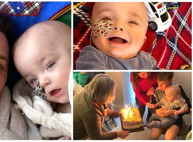 Little Hector Tully, who was given a day to live, has now celebrated his first birthday. Photos: Marie Clare Tully