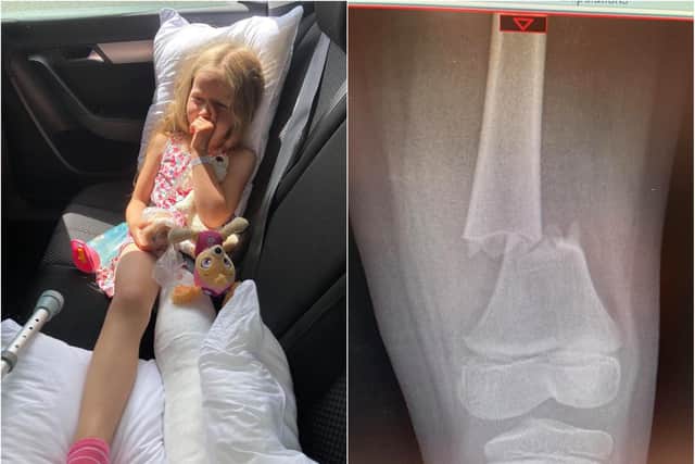 Maggie had to have her leg on the back seat of the car on the way home from hospital on Saturday (left). The x-ray show the break to her femur bone.