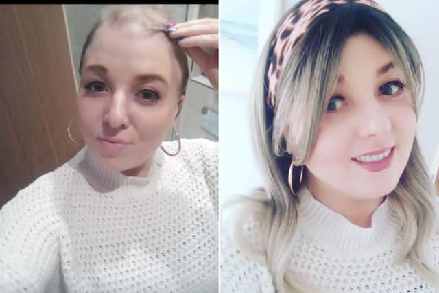 Edinburgh woman's inspiring journey as she raises awareness of living with hair loss.
