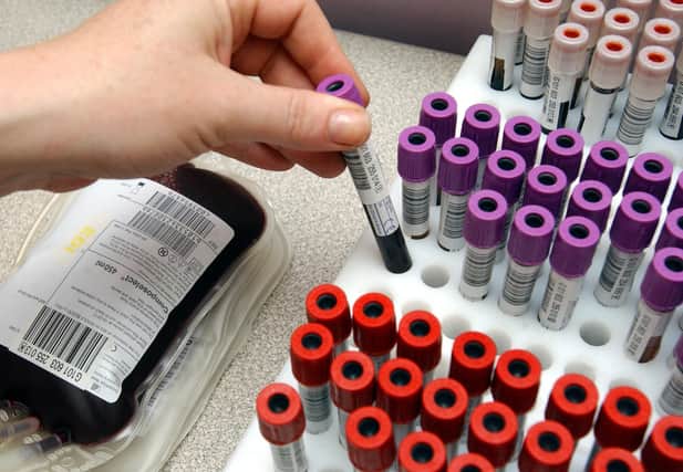 Blood transfusions undergo far more rigorous checks than during the 1980s.