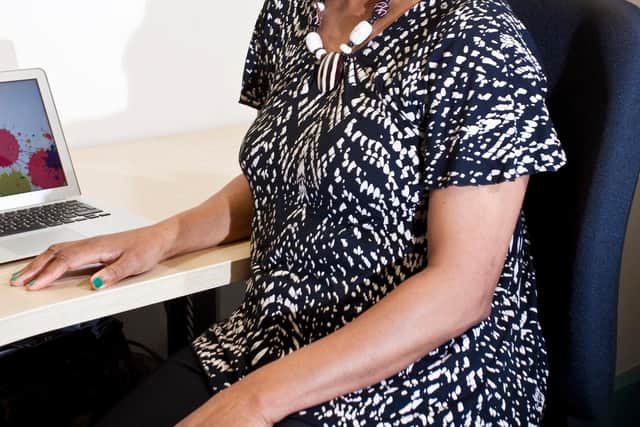 Annette West, 61, from Leith was diagnosed with measles as a child which left her severely myopic.