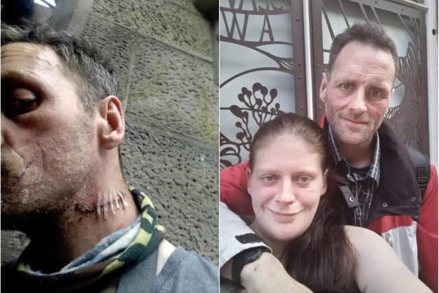 Robert Young needed stitches to his neck following the attack, witnessed by his partner Lynn O'callaghan (pictured with Robert).