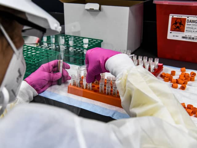 A lab technician sorts blood samples inside a lab for a Covid-19 vaccine study. Picture: Chandan Khanna/AFP via Getty Images