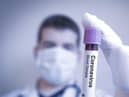 AstraZeneca issued a statement on Tuesday night saying the late-stage studies of the vaccine had been paused.