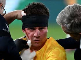 Cammy Devlin suffered a suspected concussion away on international duty with Australia. Picture: SNS