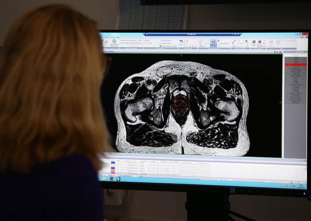A consultant clinical oncologist examines a scan showing inside the body of a 65-year-old man diagnosed with prostate cancer (Picture: Yui Mok/PA)