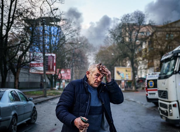 An injured man stands on a street after Russian shells hit the Ukrainian city of Kherson on Saturday. Five were killed and 20 injured in the attack (Picture: Dimitar Dilkoff/AFP via Getty Images)