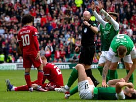 Hibs' clash with Aberdeen was a bit of a bruising affair at the (almost) end of a long old season
