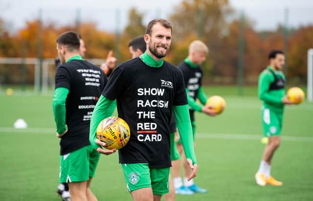 Hibs striker Christian Doidge shows his support for Show Racism the Red Card