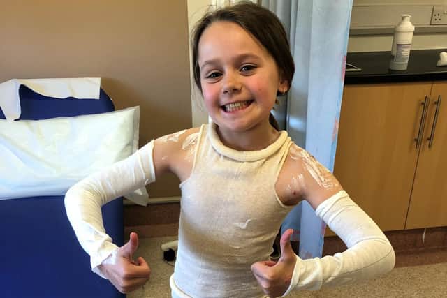 Achild member of EOS, Lexi, wearing bandages to help her eczema.