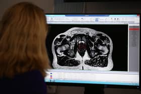 A consultant clinical oncologist examines a scan showing inside the body